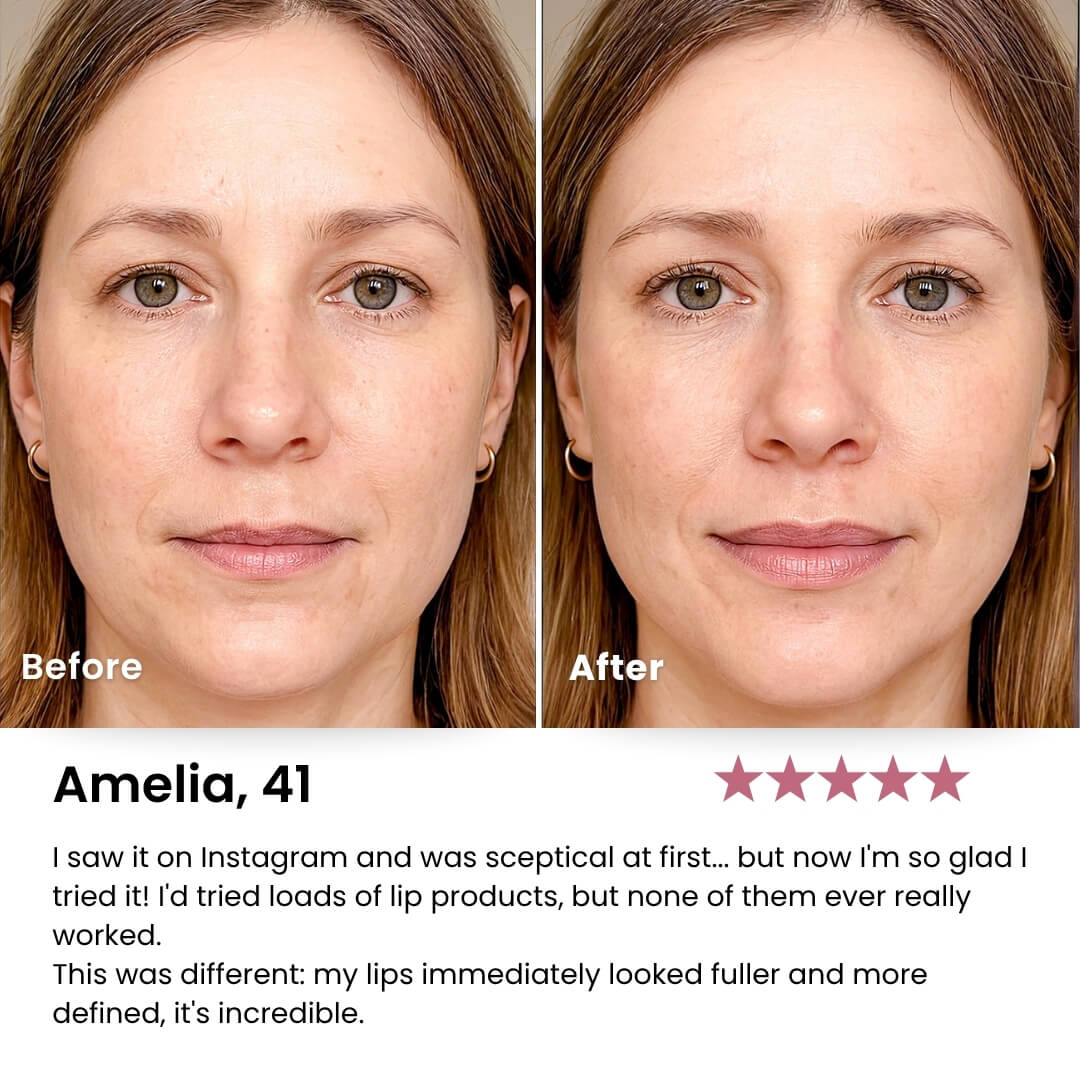 Perfect Pout™ Lip Kit