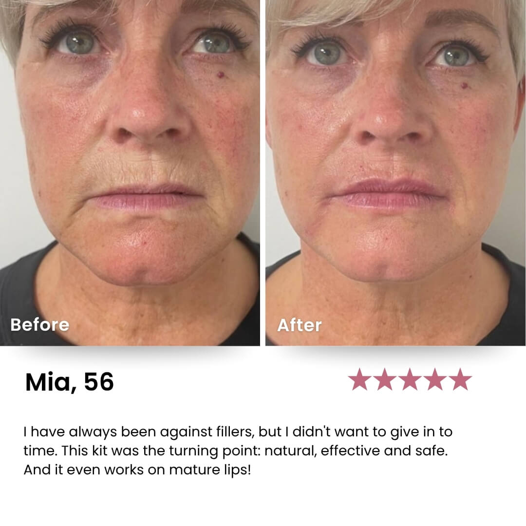 Perfect Pout™ Lip Kit