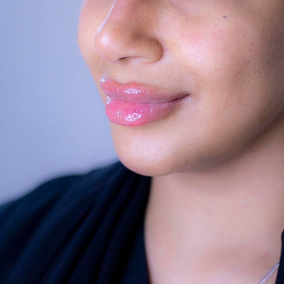 Glossive™ - Lip Plumper